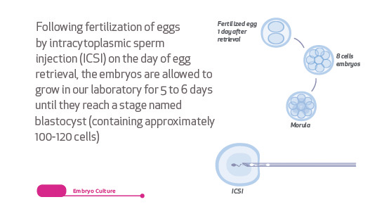 Timeline In Vitro Fertilization